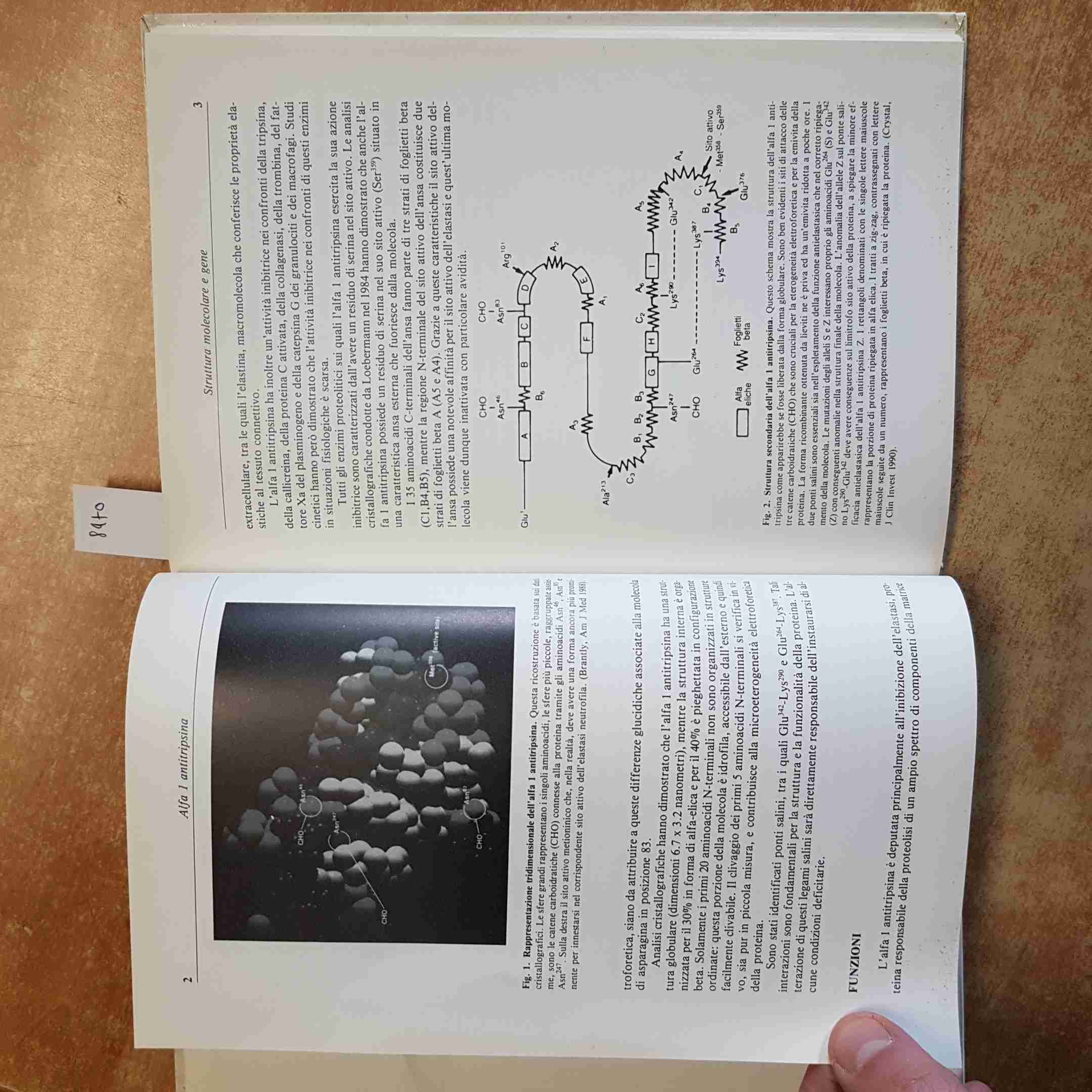 PITTSCHIELER - BIOQUÍMICA CLÍNICA PATOLÓGICA ALFA UNO ANTITRIPSINA 1993 VERDUCI